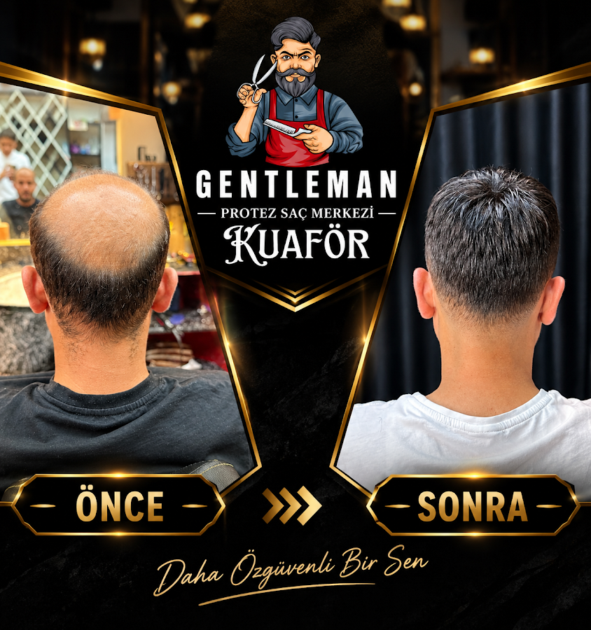 Gentleman Kuaför & Kastamonu Protez Saç