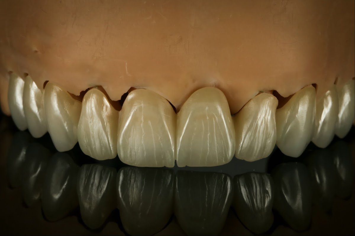 Dentizmit Ağız ve Diş Sağlığı Polikliniği - Dent İzmit Diş Sağlığı