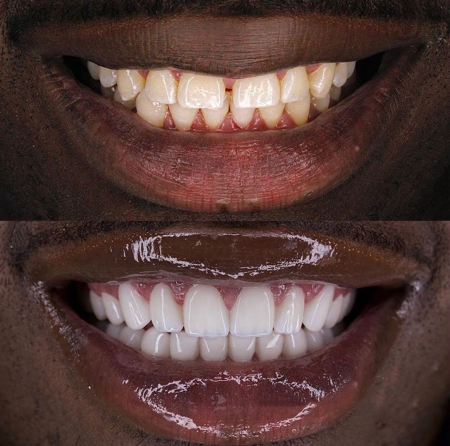 Dentist İn Antalya