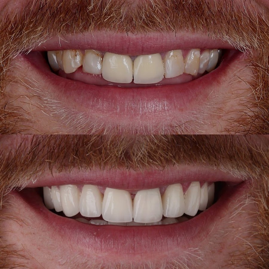 Dental Excellence Turkey