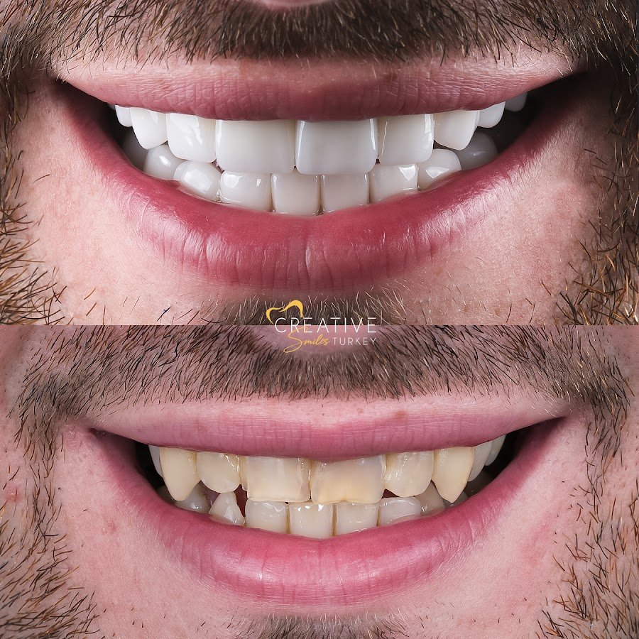 Creative Smiles Turkey (Cs) Dental Clinic