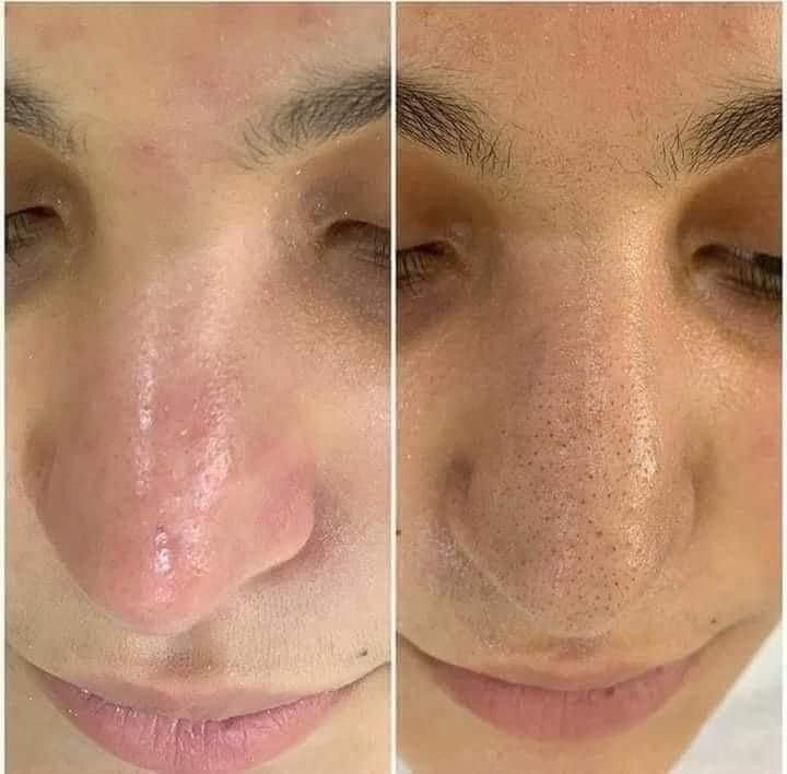 Eskişehir de Beauty Center