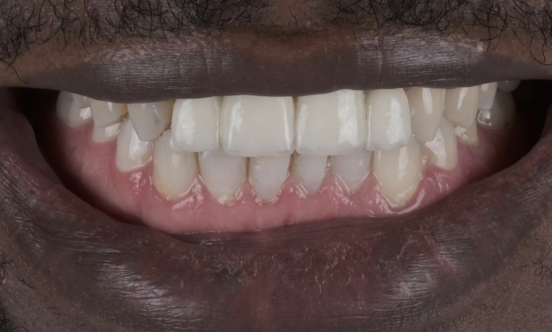 Prime Dental Turkey