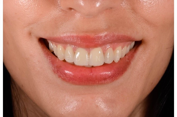 Efe Dental Klinik - Ağız ve Diş Sağlığı Polikliniği
