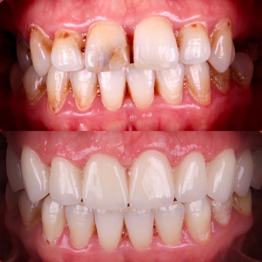 Dentium Meram - Konya, Diş Hekimi, Özel, İmplant, Zirkonyum, Gülüş Tasarımı, Çocuk