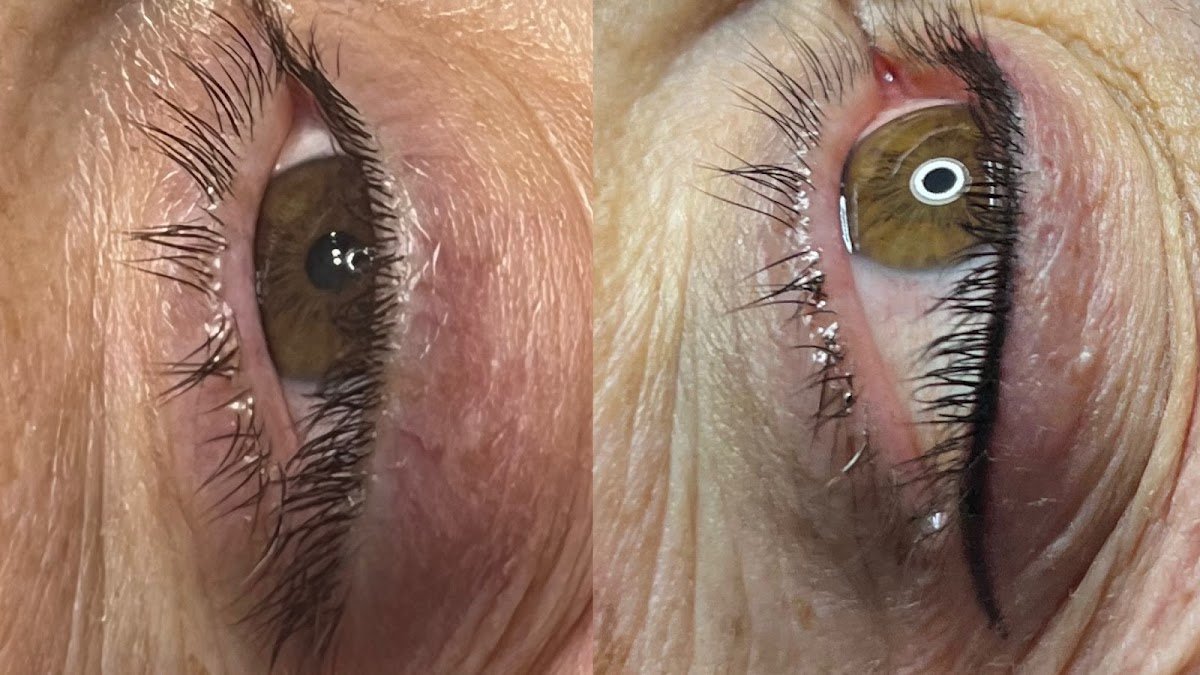 Hülya Yılmaz Beauty (Lazer Epilasyon, Cilt Bakımı, Kalıcı Makyaj, Microblading)