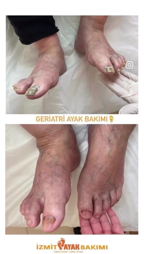 İzmit Ayak Bakımı