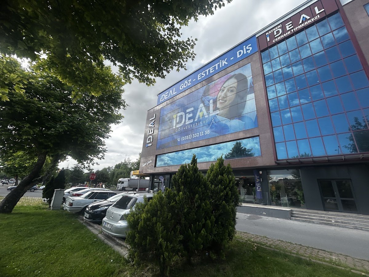 İdeal Göz Merkezi -Kayseri Göz Hastanesi- Lazer Göz Tedavisi