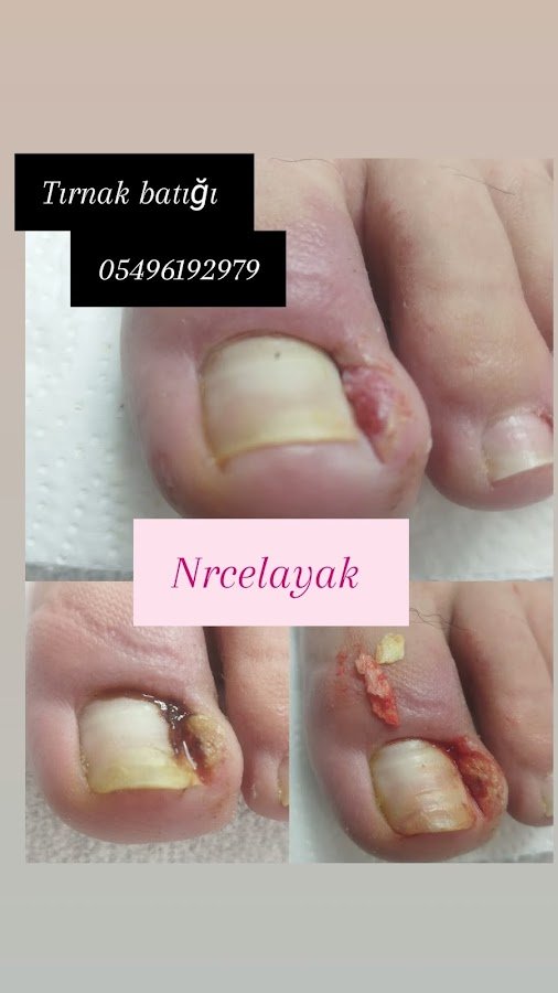 Nrc El Ayak Bakım Salonu