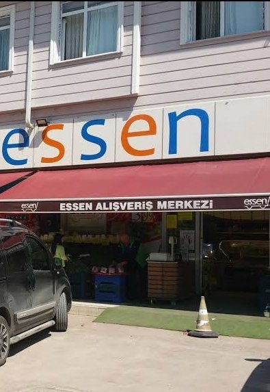 Essen AVM