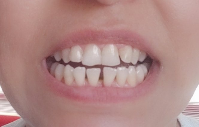 Atakent Diş Kliniği